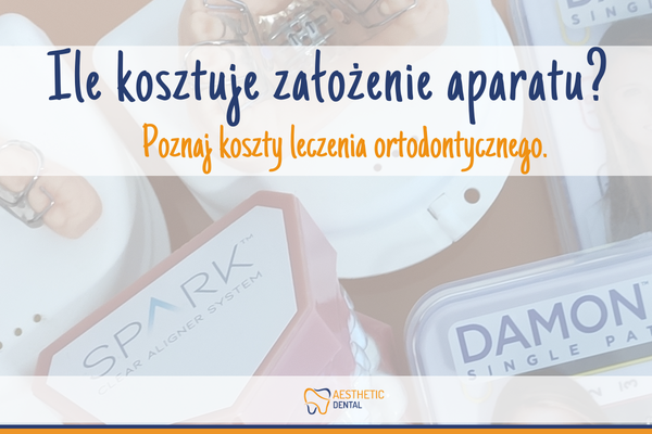 Jakie są koszty leczenia ortodontycznego? Za co płacimy podczas leczenia zębów aparatem?