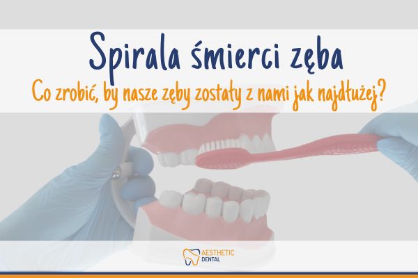 spirala śmierci zęba przedłuż życie swoich zębów zabieg icon bez użycia wiertła