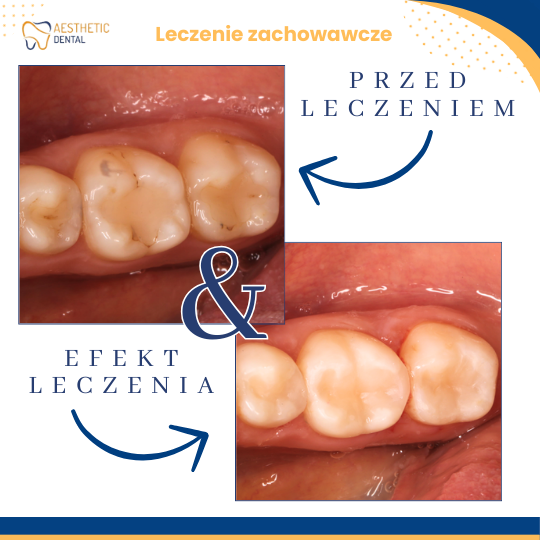 Leczenie stomatologiczne w  Piotrkowie Trybunalskim