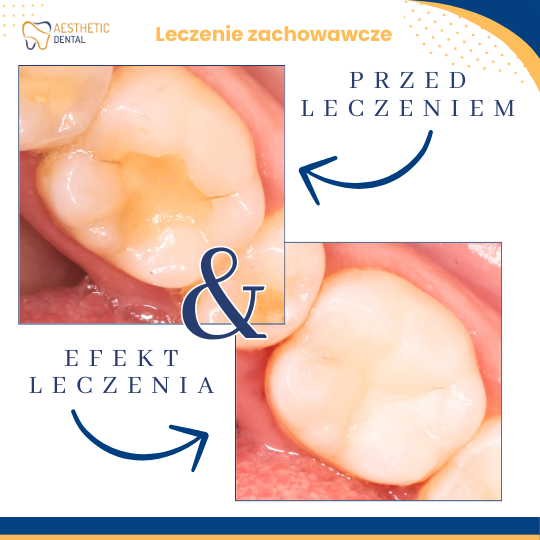 Leczenie zębów w  Piotrkowie Trybunalskim
