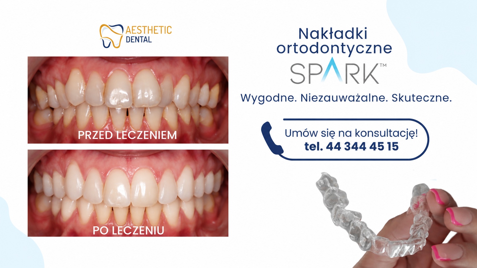 niewidzialny aparat ortodontyczny Piotrk&oacute;w Trybunalski