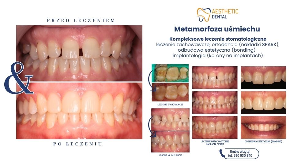 Gabinet dentystyczny w Piotrkowie Trybunalskim w którym wyleczę wszystkie zęby, leczenie stomatologiczne, ortodoncja, implanty