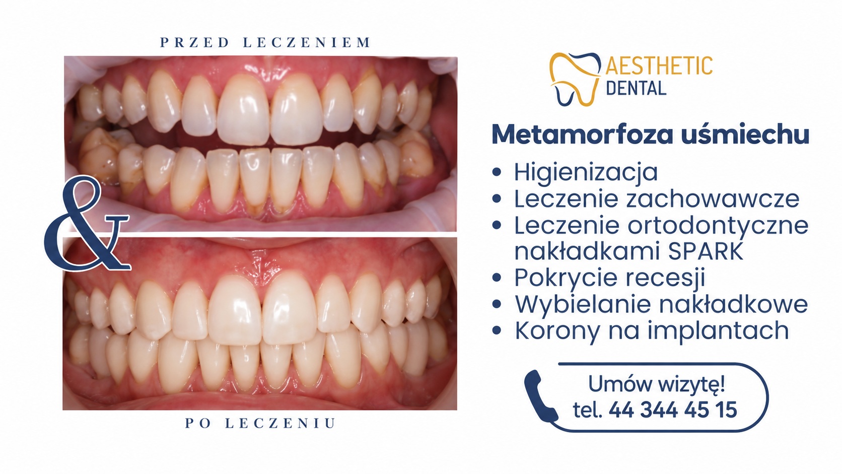 kompleksowa metamorfoza uśmiechu w Piotrkowie Trybunalskim