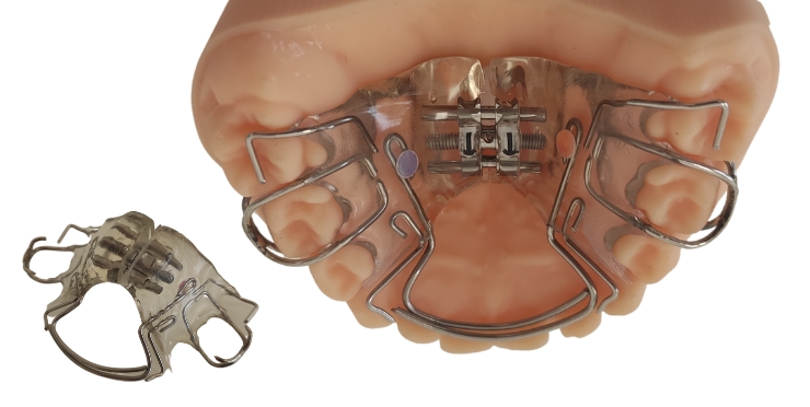 Aparat ruchomy Bioblok zakładany w przychodni Aesthetic Dental przez ortodontę w Piotrkowie Trybunalskim