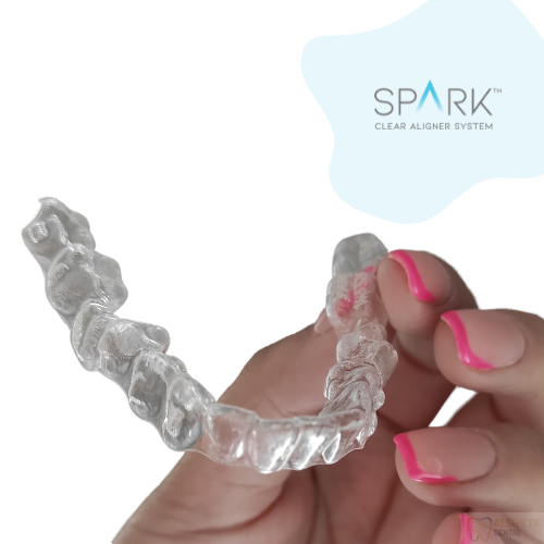 Leczenie nakładkami ortodontycznymi w Piotrkowie Trybunalskim nakładki Spark w Aesthetic Dental 