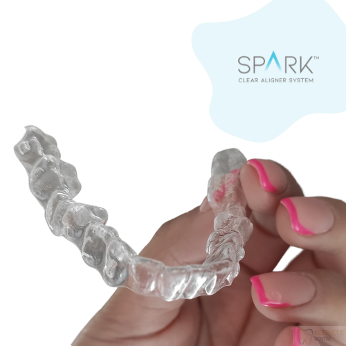 Leczenie nakładkami ortodontycznymi w Piotrkowie Trybunalskim nakładki Spark w Aesthetic Dental 
